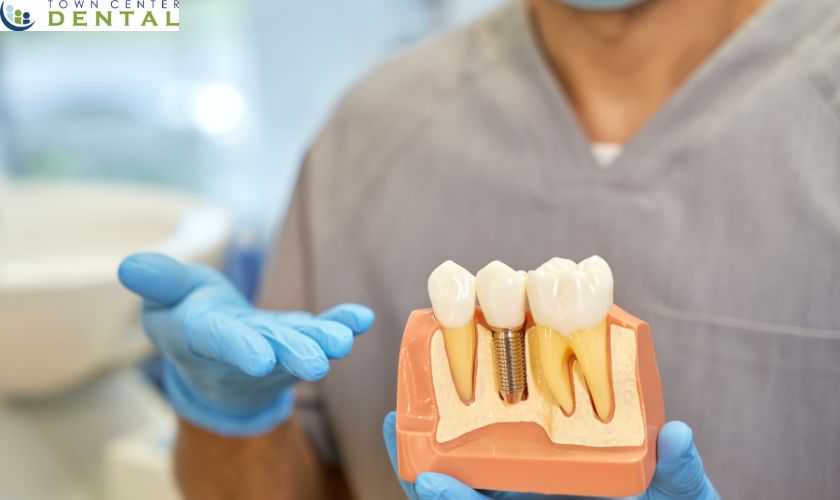 Dental implants in Lagrangeville, NY