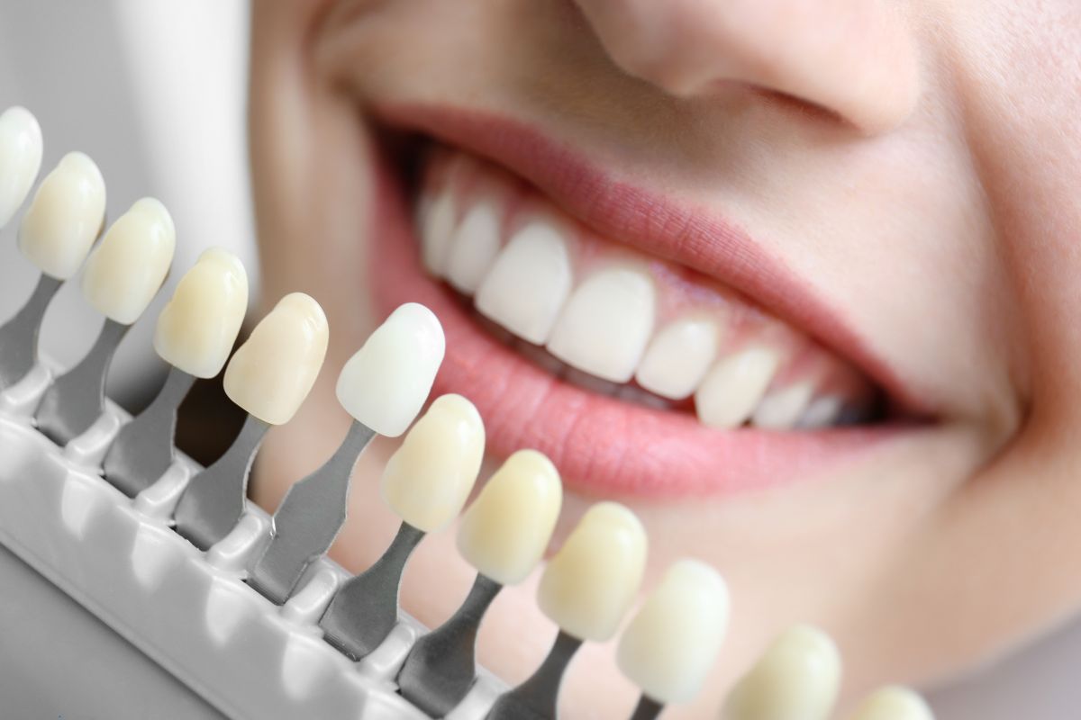 Cosmetic dentist lagrangeville