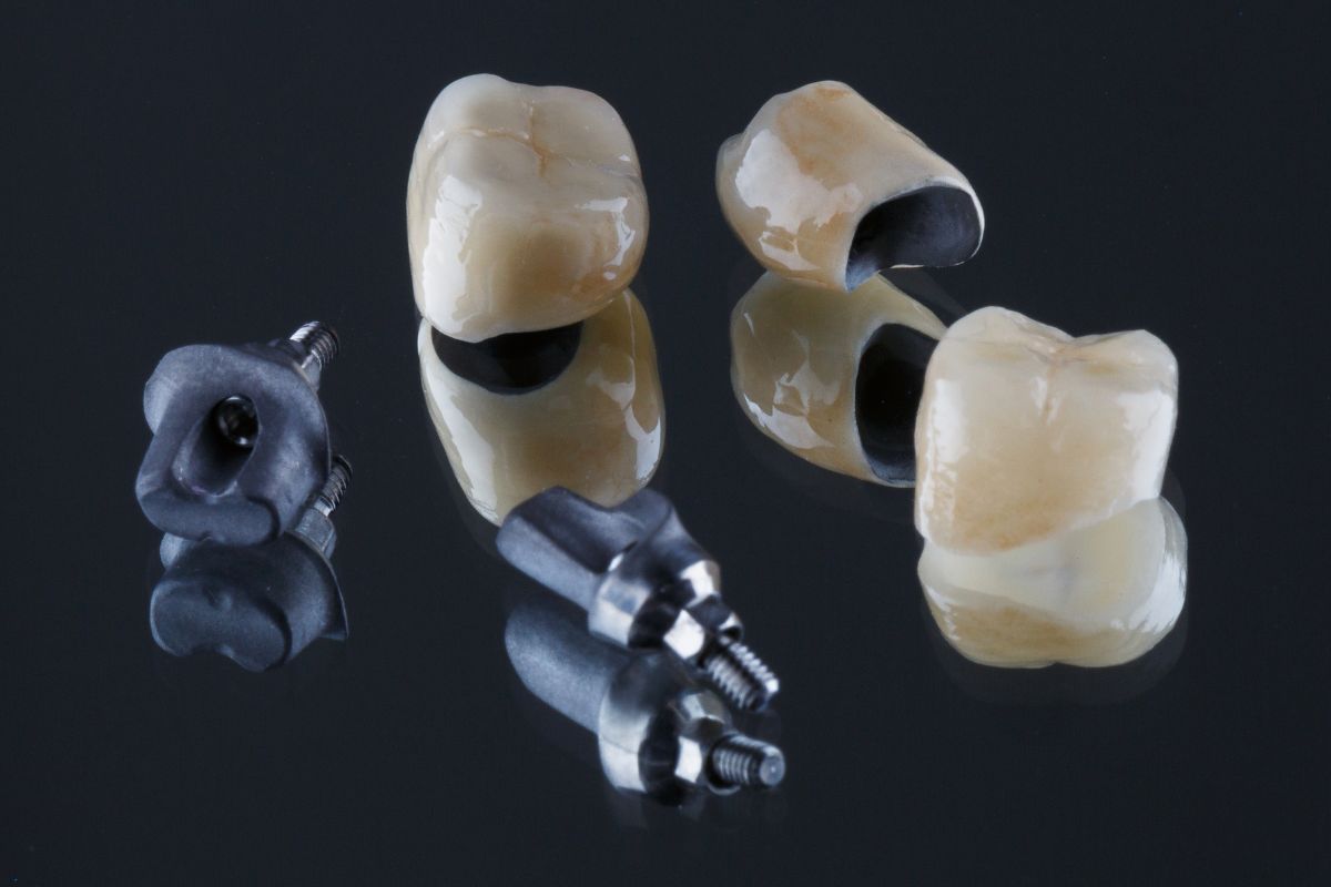 Dental crowns in Lagrangeville