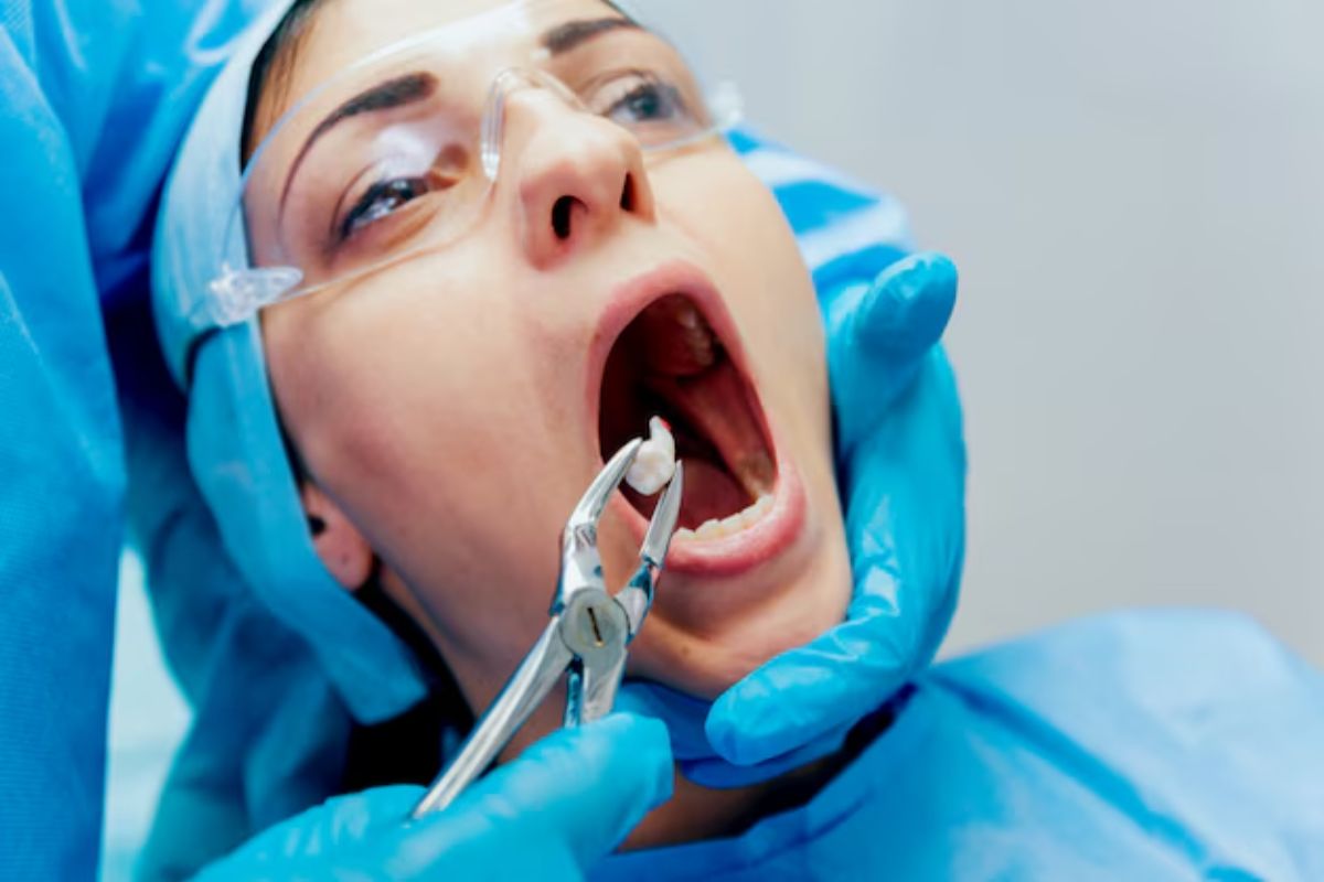Tooth Extractions in Lagrangeville