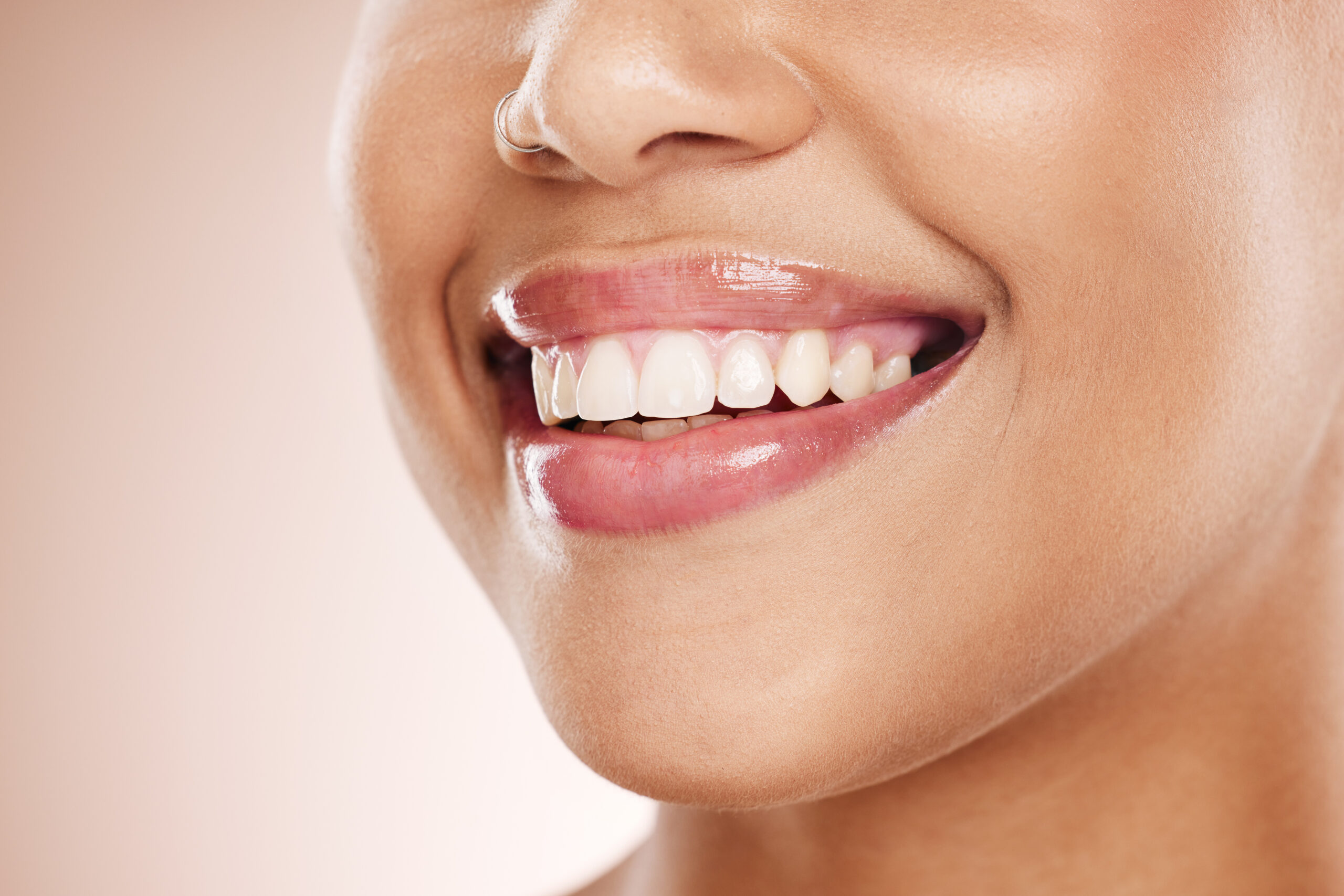 Can Cosmetic Dentistry Fix an Overbite?