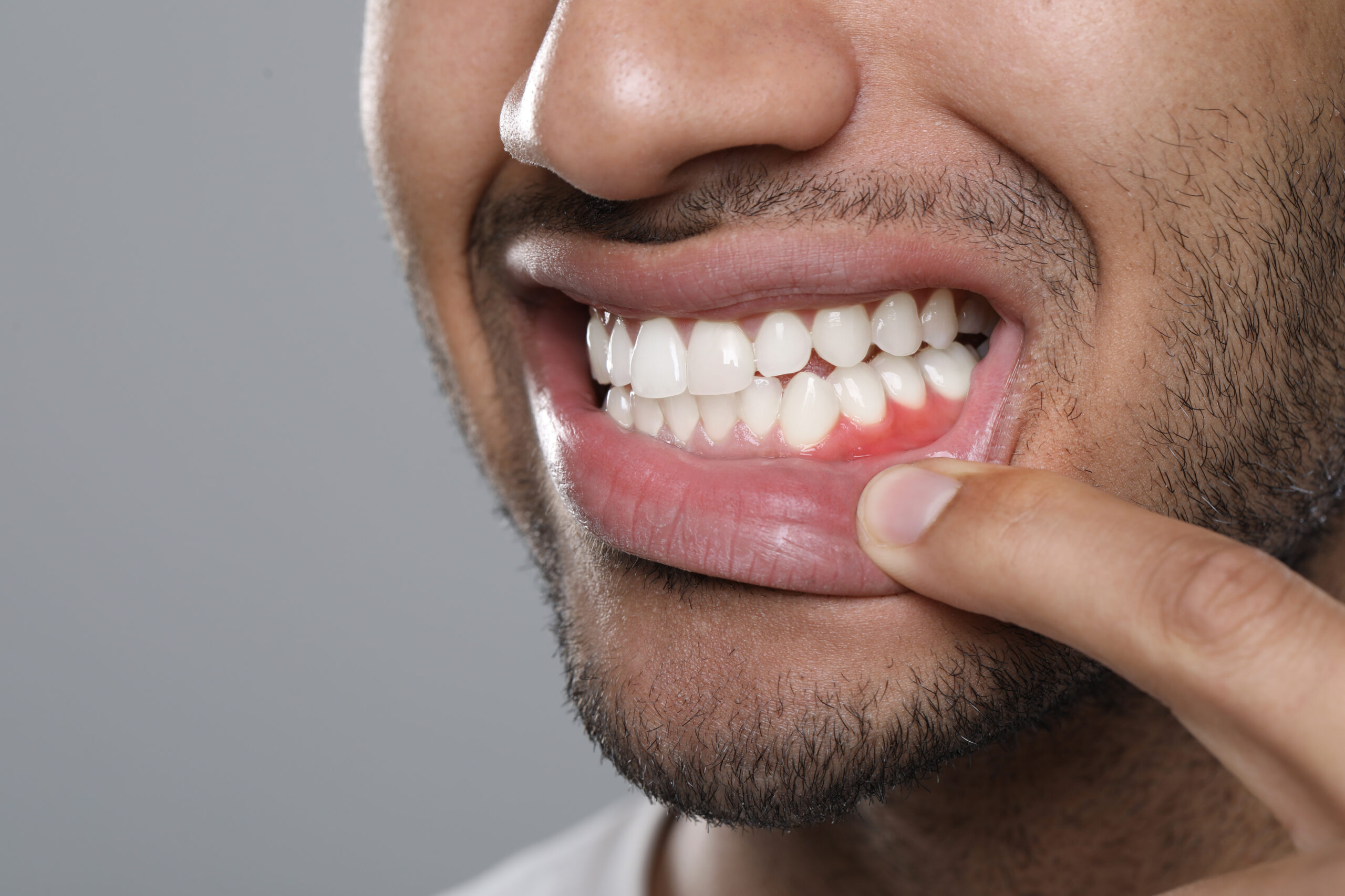 Gum Disease Treatment in Lagrangeville